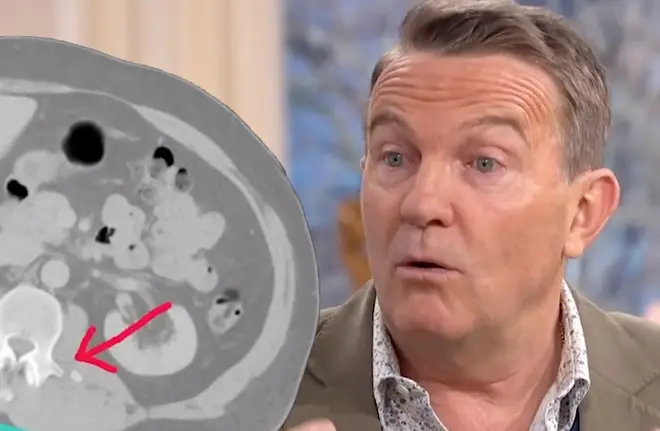 Bradley Walsh has broken his back in three places after falling from a bull