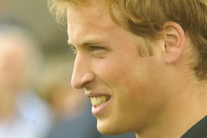 Prince William scar