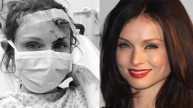 Sophie Ellis-Bextor is in hospital after a serious cycle accident