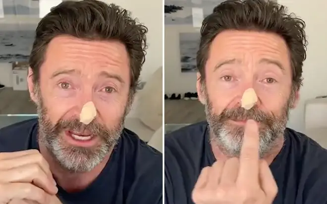 Hugh Jackman has revealed his latest skin cancer scare.