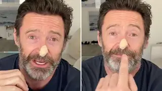 Hugh Jackman has revealed his latest skin cancer scare.
